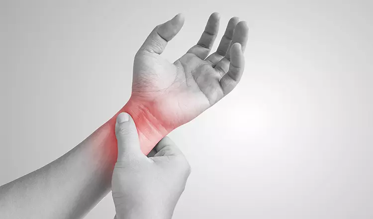 Síndrome do Túnel do Carpo: O que é, Sintomas e Tratamento